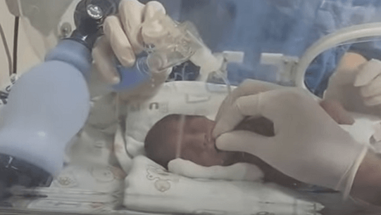 Neonatal Digital intubation Flow curve confirmation